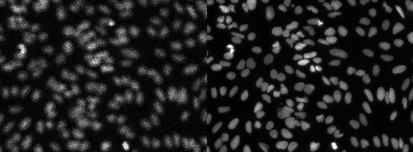 Deep Learning for Biomedical Imaging