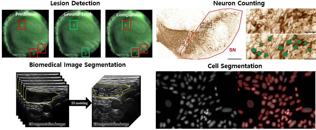 Segmentation & Detection