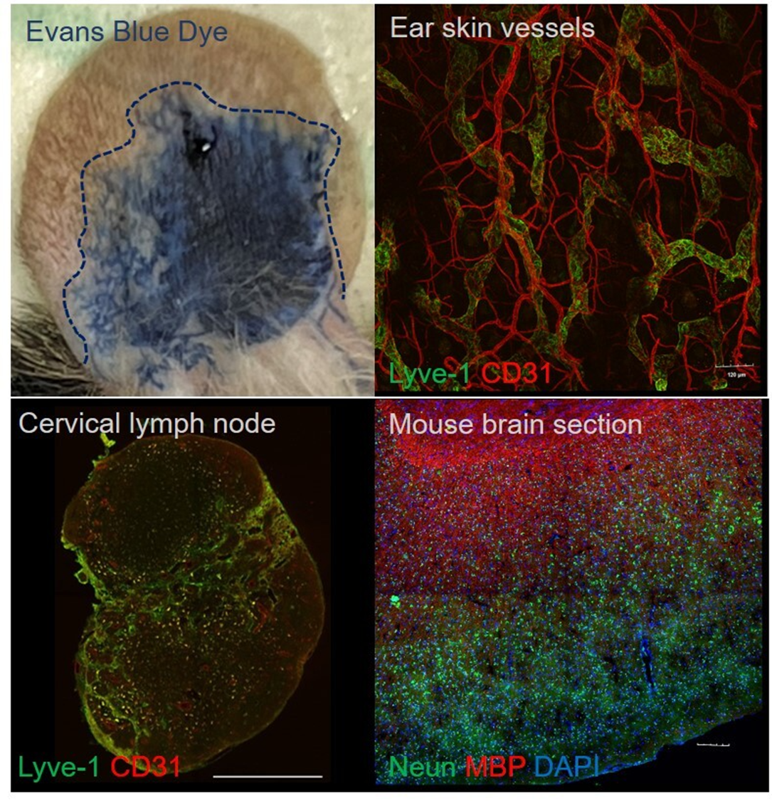 Vascular dysfunction in Neurological disorders